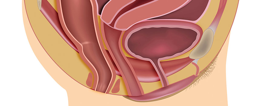 Pelvic Organ Prolapse: Types, Causes and Symptoms