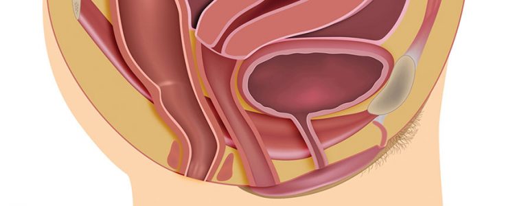 Diagnosis And Management Of Pelvic Organ Prolapse The Basics Womens