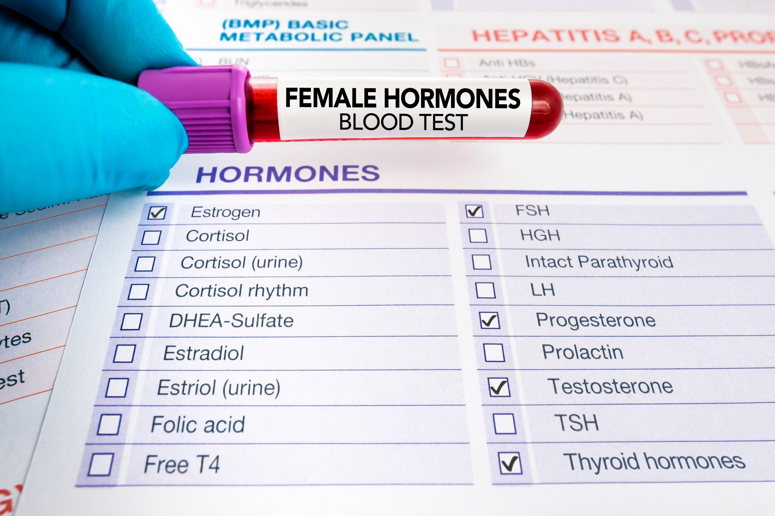 At Home Women's Hormone Level Test