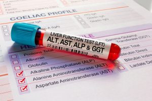 Liver blood tests recommended as part of Veozah prescribing practice